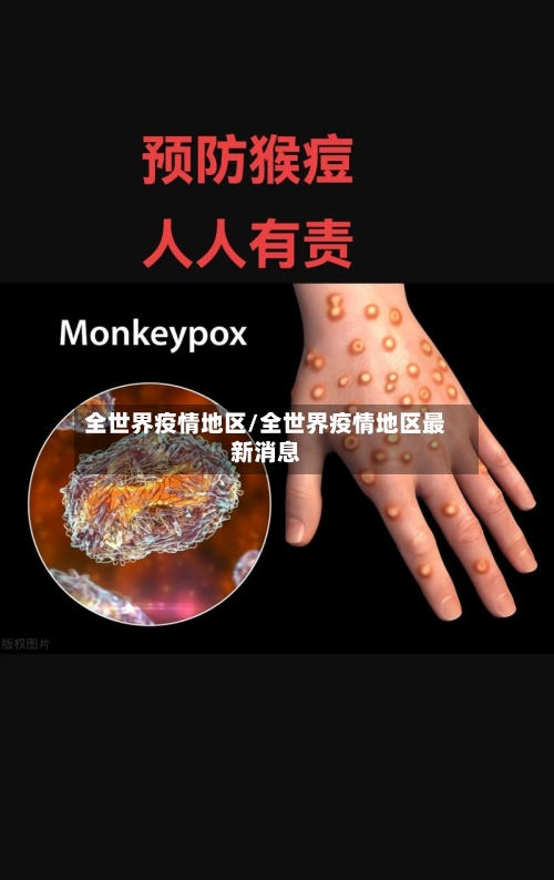 全世界疫情地区/全世界疫情地区最新消息-第2张图片