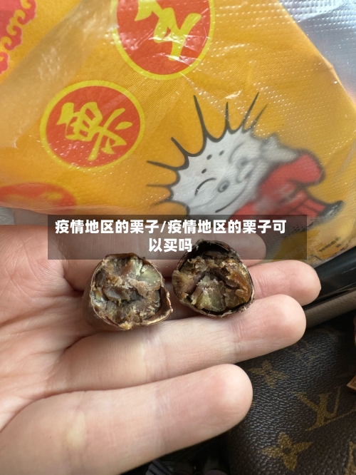 疫情地区的栗子/疫情地区的栗子可以买吗